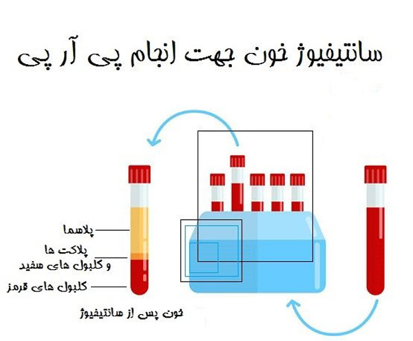 پی آر پی - مهران رضایی