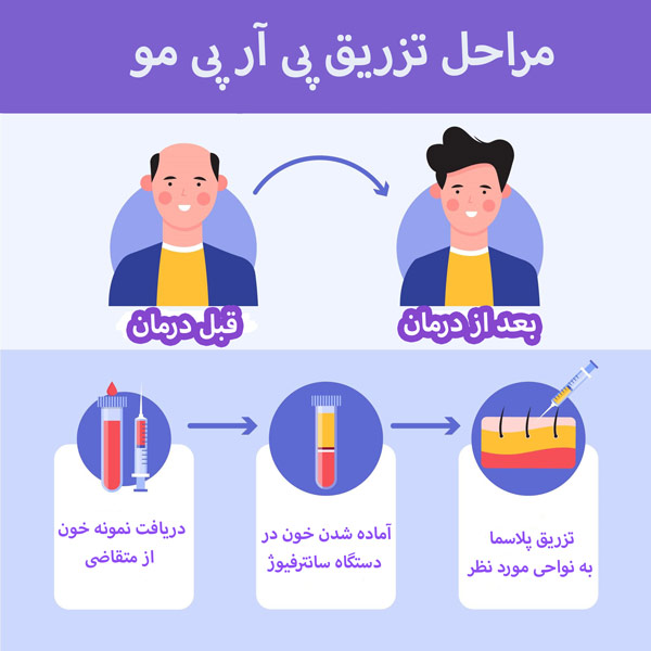 پی آر پی - مهران رضایی