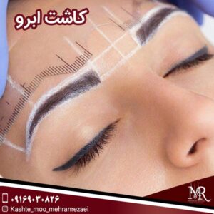 کاشت ابرو - تیم تخصص مهران رضایی