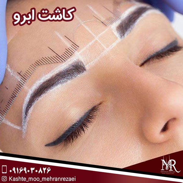 کاشت ابرو - تیم تخصص مهران رضایی