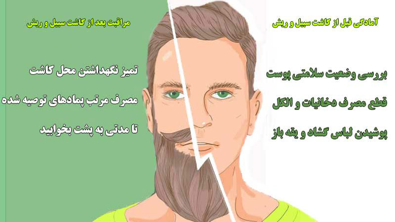 کاشت ریش و سبیل - مهران رضائی