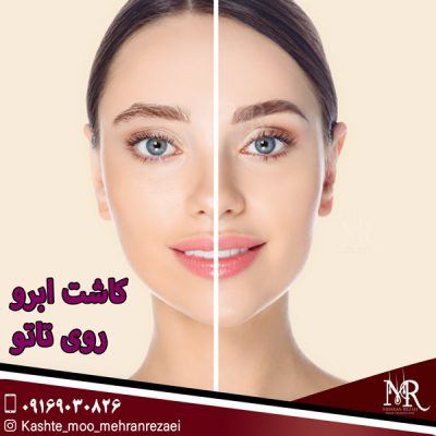 کاشت ابرو روی تاتو - مهران رضایی