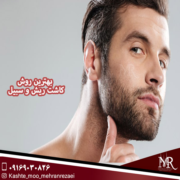 بهترین روش کاشت ریش و سبیل - مهران رضایی