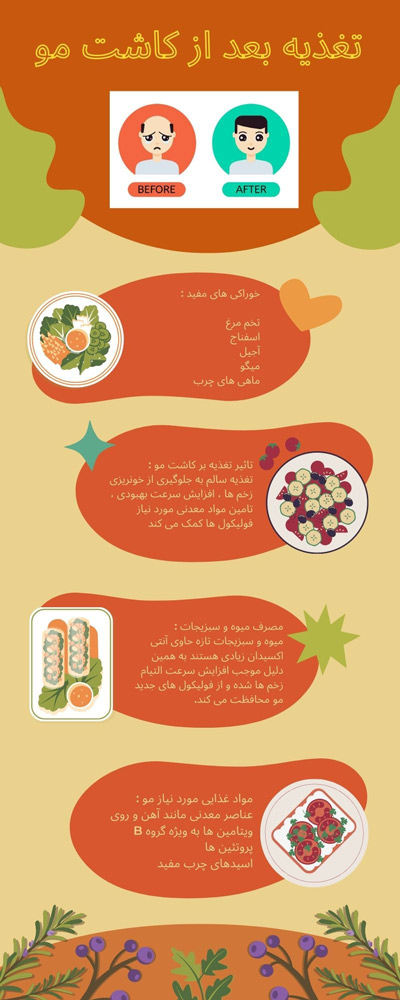 تغذیه بعد از کاشت مو - مهران رضایی
