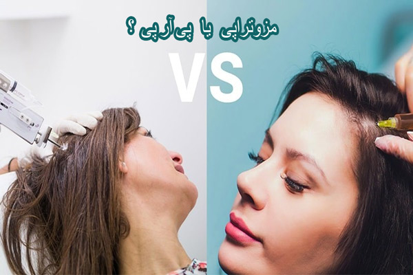 تفاوت مزوتراپی و پی آر پی مو - مهران رضایی