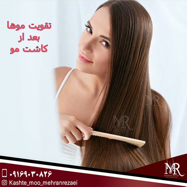 تقویت موها بعد از کاشت مو - رضایی