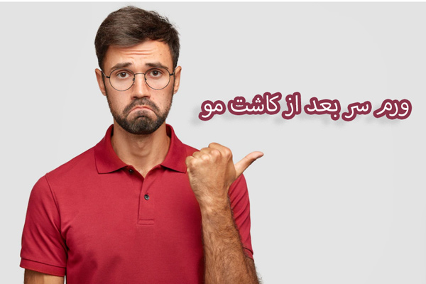 ورم سر بعد از کاشت مو - مهران رضایی
