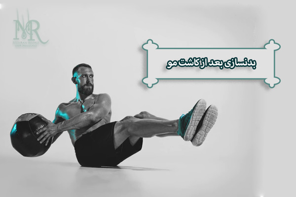 ورزش کردن بعد از کاشت مو - مهران رضایی