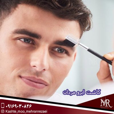 کاشت ابرو مردان - مهران رضایی