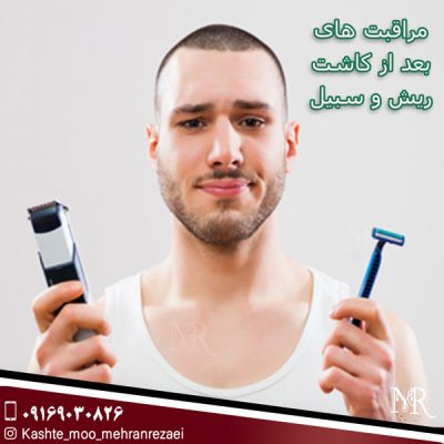 مراقبت های بعد از کاشت ریش و سبیل - مهران رضایی