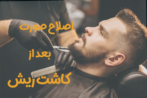 مراقبت های بعد از کاشت ریش و سبیل - مهران رضایی