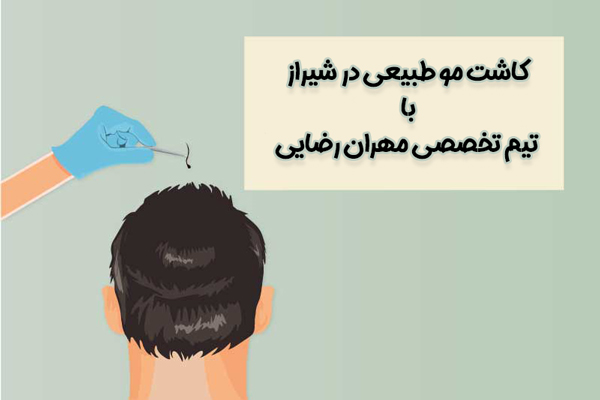 کاشت مو در شیراز - مهران رضایی