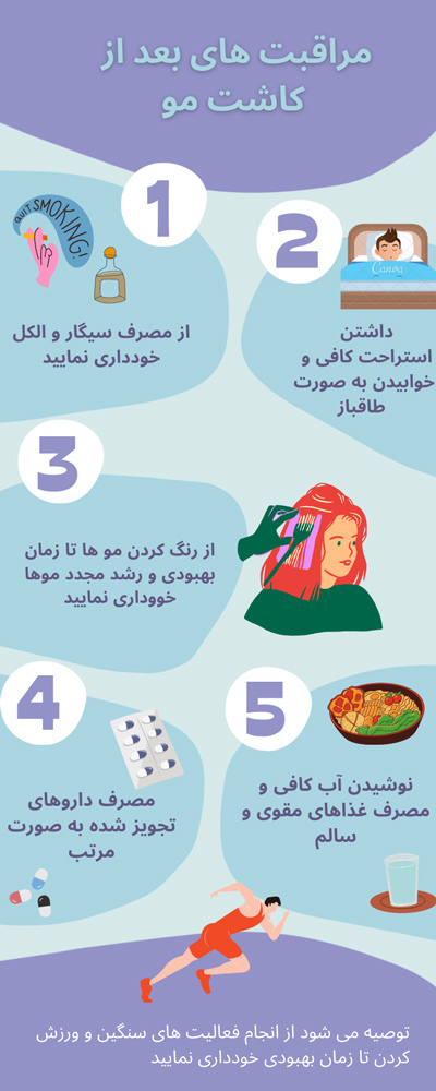 کاشت مو در شیراز - مهران رضایی