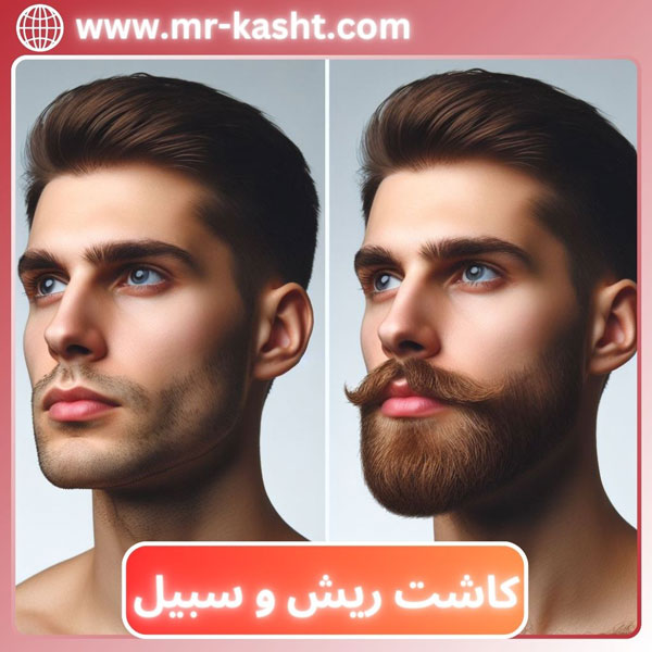 کاشت ریش و سبیل مهران رضایی