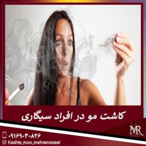 کاشت مو در افراد سیگاری | تیم تخصصی مهران رضایی