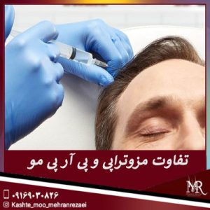 تفاوت مزوتراپی و پی آر پی مو | تیم تخصصی کاشت مو مهران رضایی شیراز