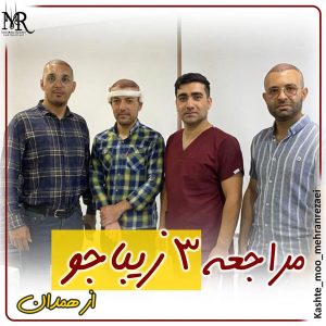 نمونه کار کاشت مو | تیم تخصصی مهران رضایی