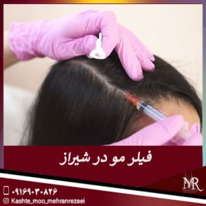 فیلر مو در شیراز | تیم تخصصی کاشت مو مهران رضایی