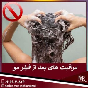 مراقبت های بعد از تزریق فیلر مو - تیم تخصصی مهران رضایی در شیراز