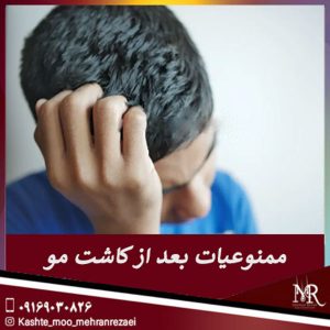 ممنوعیات بعد از کاشت مو - تیم تخصصی مهران رضایی 