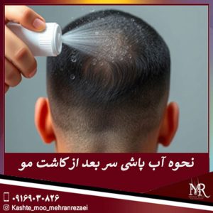 نحوه آب پاشی سر بعد از کاشت مو - مهران رضایی
