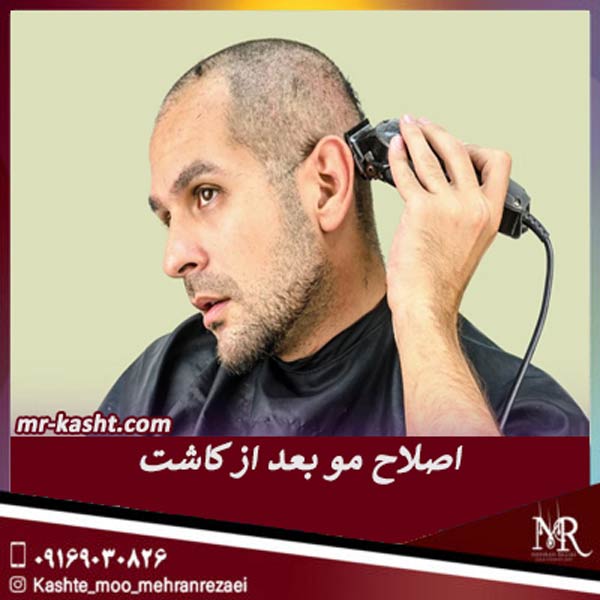 اصلاح مو بعد از کاشت - تیم تخصصی کاشت مو مهران رضایی در شیراز