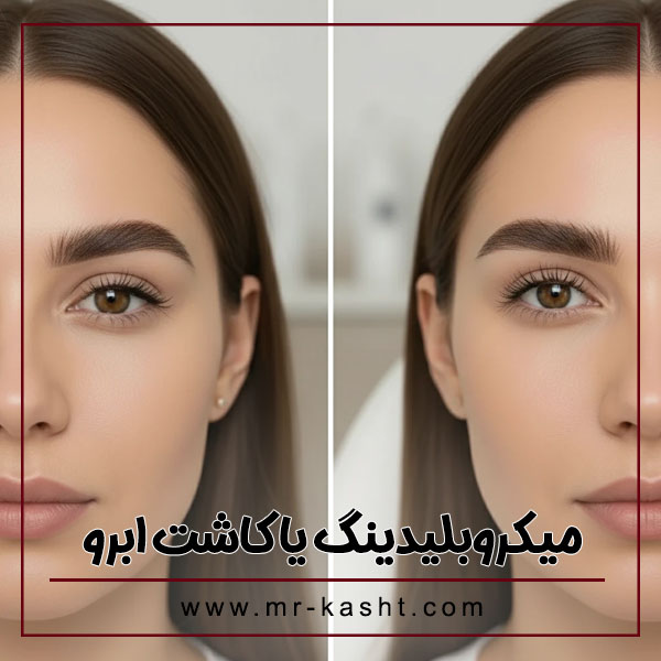 میکروبیلدینگ یا کاشت ابرو + تیم تخصصی کاشت مو مهران رضایی
