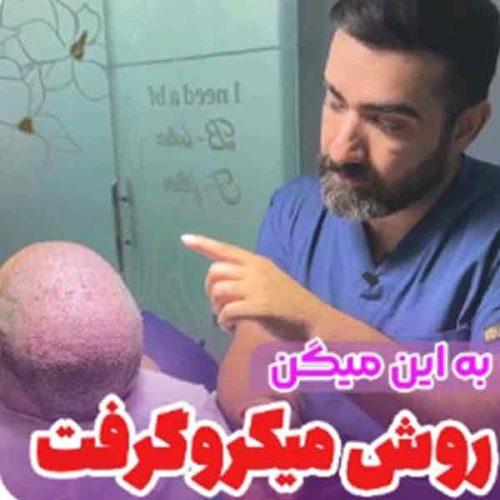 hair-transplant10