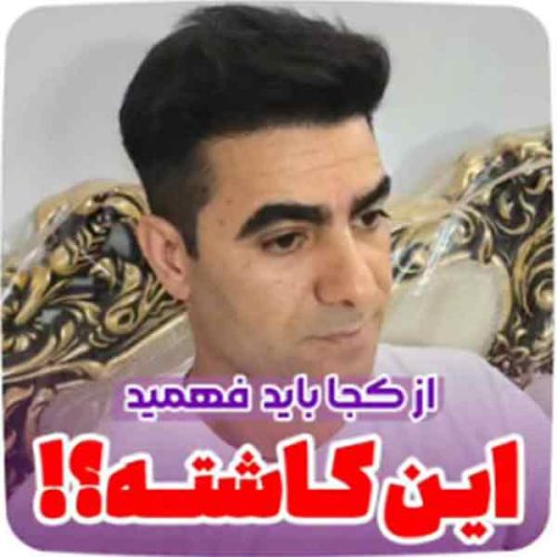 hair-transplant16