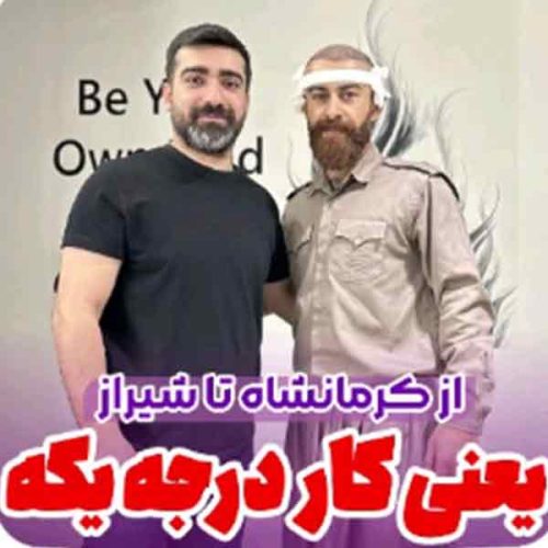 hair-transplant20