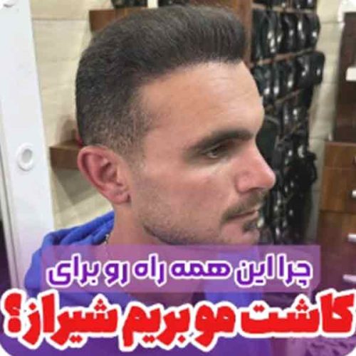 hair-transplant6