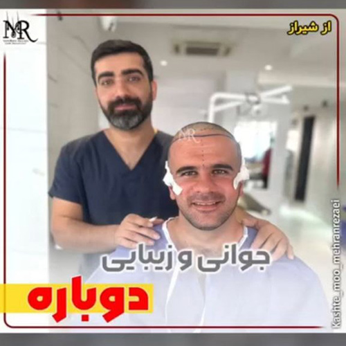 کاشت-مو-33