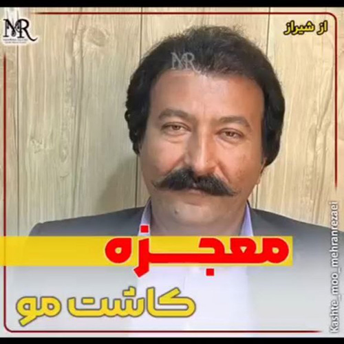 کاشت-مو-36
