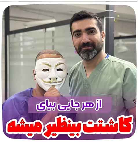 کاشت-مو-47