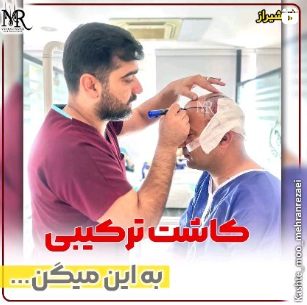 کاشت-مو-25