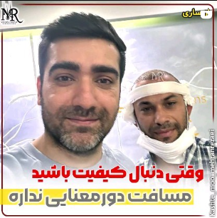 کاشت-مو-27