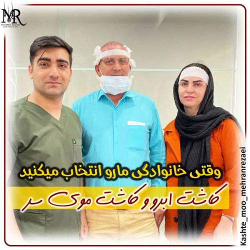 کاشت-مو-13