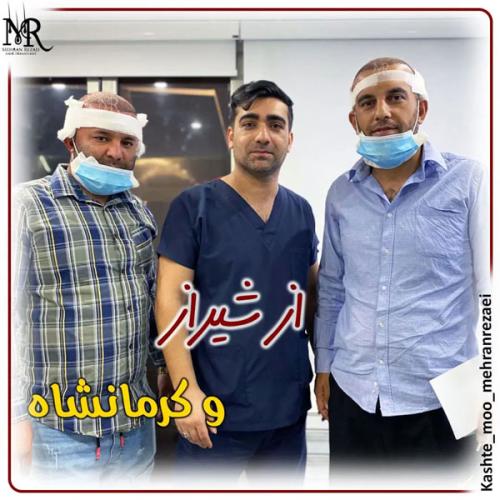 کاشت-مو-14