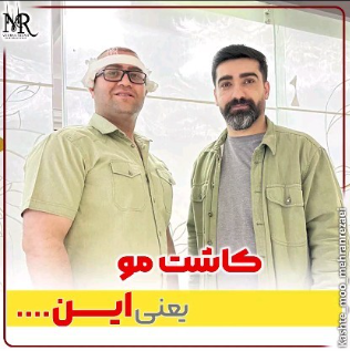 کاشت-مو-20